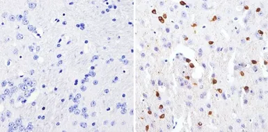 Anti-GATA3 antibody [1A12-1D9] used in IHC (Paraffin sections) (IHC-P). GTX30600