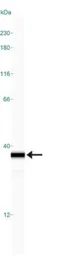 Anti-NQO1 antibody [A180] used in Western Blot (WB). GTX30626