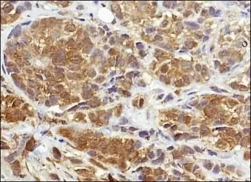 Anti-NQO1 antibody [A180] used in IHC (Paraffin sections) (IHC-P). GTX30626