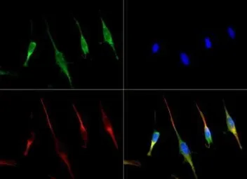 Anti-SLC31A1 / CTR1 antibody used in Immunocytochemistry/ Immunofluorescence (ICC/IF). GTX30642