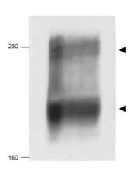 Anti-NPC1 antibody used in Western Blot (WB). GTX30687