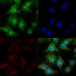 Anti-NPC1 antibody used in Immunocytochemistry/ Immunofluorescence (ICC/IF). GTX30687