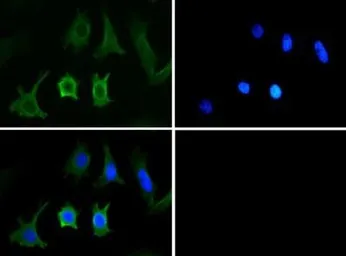 Anti-NPC1 antibody used in Immunocytochemistry/ Immunofluorescence (ICC/IF). GTX30687