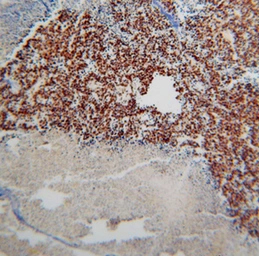 Anti-TDP43 antibody used in IHC (Paraffin sections) (IHC-P). GTX30809