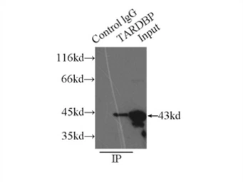 Anti-TDP43 antibody used in Immunoprecipitation (IP). GTX30809