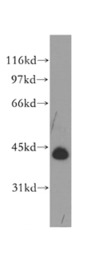 Anti-TDP43 antibody used in Western Blot (WB). GTX30809