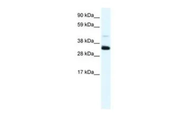 Anti-Annexin III antibody, N-term used in Western Blot (WB). GTX30892