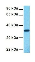 Anti-Annexin III antibody, N-term used in Western Blot (WB). GTX30892