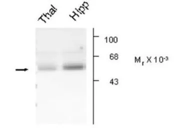 Anti-GABA A Receptor alpha 5 antibody used in Western Blot (WB). GTX31004