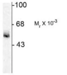 Anti-GABA A Receptor alpha 5 antibody used in Western Blot (WB). GTX31004