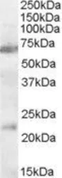 Anti-AChR alpha 4 antibody, Internal used in Western Blot (WB). GTX31078