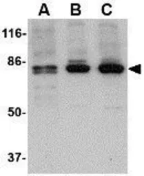 Anti-CCK4 antibody used in Western Blot (WB). GTX31322