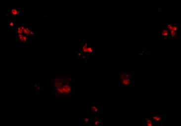 Anti-KCTD15 antibody used in IHC (Paraffin sections) (IHC-P). GTX31374