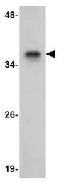 Anti-JMJD8 antibody used in Western Blot (WB). GTX31388