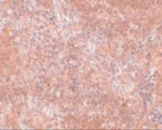 Anti-JMJD8 antibody used in IHC (Paraffin sections) (IHC-P). GTX31388