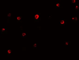 Anti-IRF4 / MUM1 antibody used in Immunocytochemistry/ Immunofluorescence (ICC/IF). GTX31438