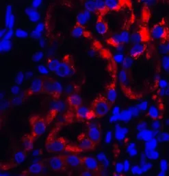 Anti-TRPV4 antibody used in IHC (Paraffin sections) (IHC-P). GTX31567