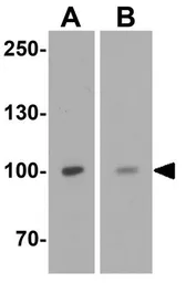 Anti-TRPV4 antibody used in Western Blot (WB). GTX31567