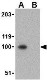 Anti-Nephrin antibody used in Western Blot (WB). GTX31654