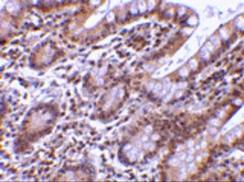 Anti-Livin antibody used in IHC (Paraffin sections) (IHC-P). GTX31663