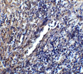 Anti-STIM1 antibody used in IHC (Paraffin sections) (IHC-P). GTX31757