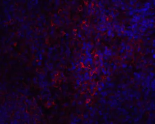 Anti-STIM1 antibody used in Immunocytochemistry/ Immunofluorescence (ICC/IF). GTX31757