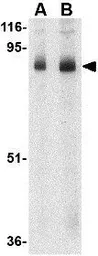 Anti-STIM1 antibody used in Western Blot (WB). GTX31757