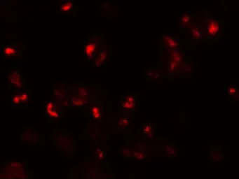 Anti-CD229 antibody used in Immunocytochemistry/ Immunofluorescence (ICC/IF). GTX31832