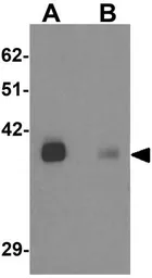 Anti-KCNK12 antibody used in Western Blot (WB). GTX31840