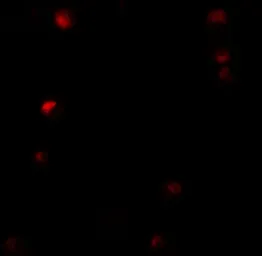 Anti-LAP2 antibody used in Immunocytochemistry/ Immunofluorescence (ICC/IF). GTX31844