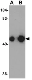 Anti-KREMEN1 antibody used in Western Blot (WB). GTX31876