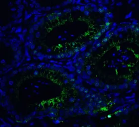 Anti-BRG1 antibody used in IHC (Paraffin sections) (IHC-P). GTX31917