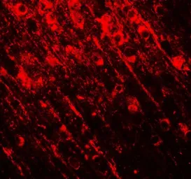 Anti-BRG1 antibody used in IHC (Paraffin sections) (IHC-P). GTX31917