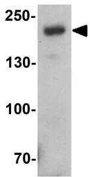 Anti-BRG1 antibody used in Western Blot (WB). GTX31917