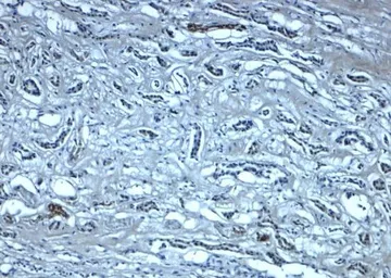 Anti-Nephrin antibody used in IHC (Paraffin sections) (IHC-P). GTX31936