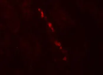 Anti-Nephrin antibody used in IHC (Paraffin sections) (IHC-P). GTX31936