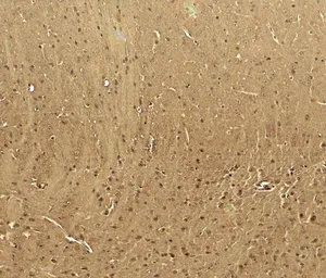 Anti-Cav3.2 antibody used in IHC (Paraffin sections) (IHC-P). GTX31939