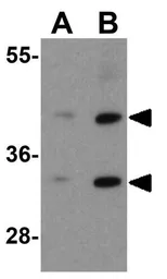 Anti-KIR2DS2 antibody used in Western Blot (WB). GTX31949