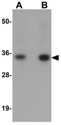 Anti-Calneuron 1 antibody used in Western Blot (WB). GTX31988