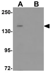 Anti-L1TD1 antibody used in Western Blot (WB). GTX32026