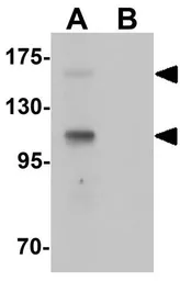 Anti-RUSC2 antibody used in Western Blot (WB). GTX32050