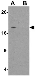 Anti-SPINK2 antibody used in Western Blot (WB). GTX32051