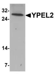 Anti-YPEL2 antibody used in Western Blot (WB). GTX32063