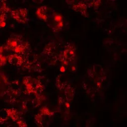 Anti-TMEM106B antibody used in IHC (Paraffin sections) (IHC-P). GTX32067