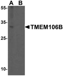 Anti-TMEM106B antibody used in Western Blot (WB). GTX32067