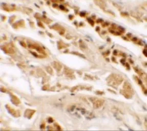 Anti-TTYH2 antibody used in IHC (Paraffin sections) (IHC-P). GTX32075