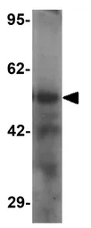 Anti-TTYH2 antibody used in Western Blot (WB). GTX32075