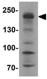 Anti-SHROOM3 antibody used in Western Blot (WB). GTX32099