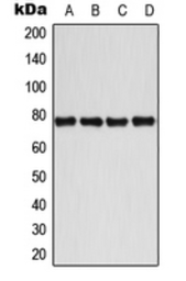 Anti-BMX (phospho Tyr40) antibody used in Western Blot (WB). GTX32164