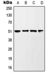 Anti-GSK3 alpha (phospho Ser21) antibody used in Western Blot (WB). GTX32191